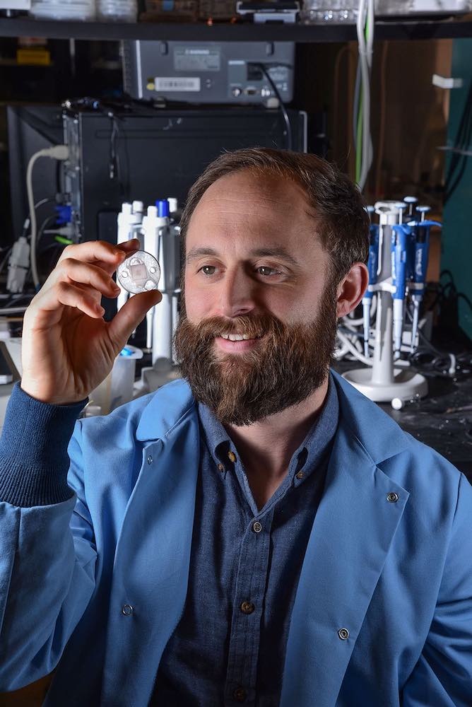 Photo of Philip Miller's microneedle device.