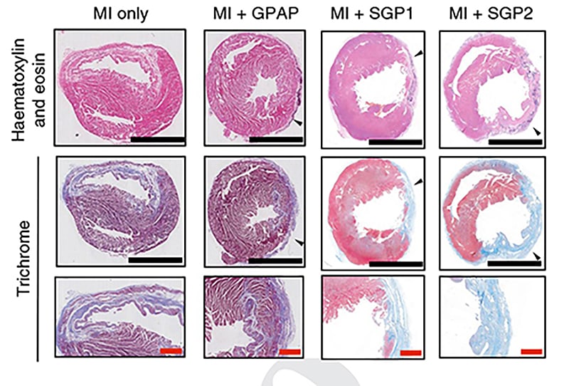 Hearts Patched Image