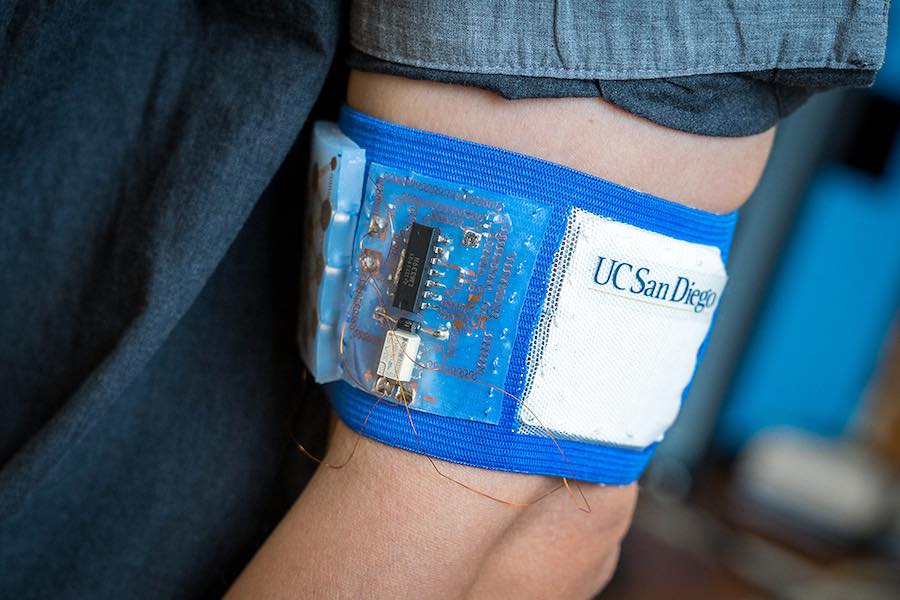 Image of Mesh Armband Prototype
