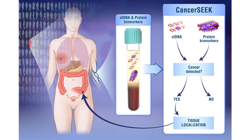 Cancer Detection Test Single Blood Test Screens for Eight Cancer Types - Medical Design Briefs