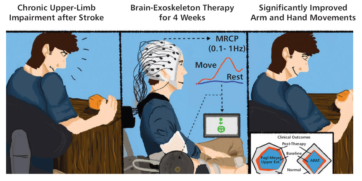Tapping the Brain to Boost Stroke Rehabilitation - Tech Briefs