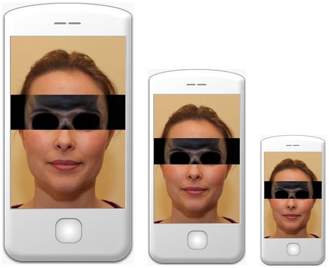Different GIF App sizes for X-Ray animation