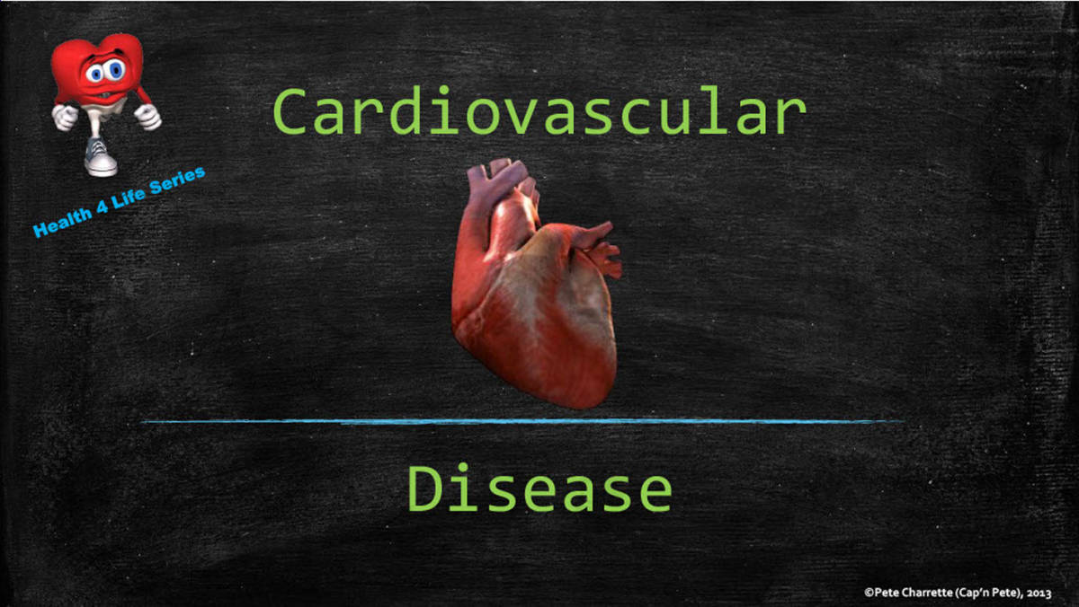 An educational teaching resource from Cap'n Pete's Power PE entitled Health 4 Life PowerPoint Series: Cardiovascular Disease downloadable at Teach Simple.