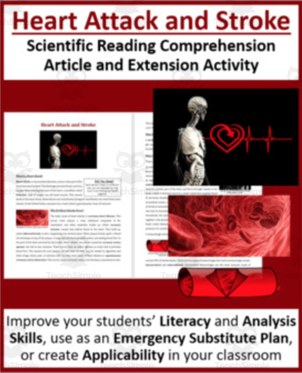 An educational teaching resource from Teach With Fergy entitled Heart Attack and Stroke - Reading Article - Grade 8 and Up downloadable at Teach Simple.