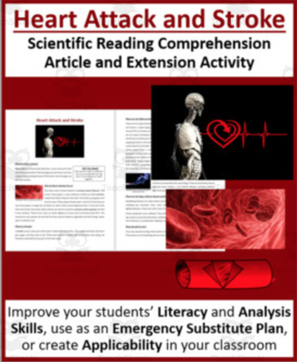 An educational teaching resource from Teach With Fergy entitled Heart Attack and Stroke - Science Reading Article - Grades 5-7 downloadable at Teach Simple.