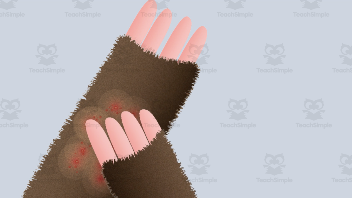 An educational teaching resource from Educational Voice entitled Rash | English Conversations Video Lesson downloadable at Teach Simple.