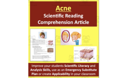 Acne Reading Comprehension Article