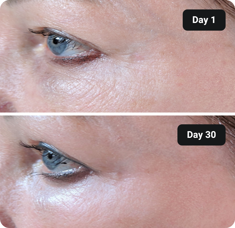 Bioactive Collagen Peptides before and after results