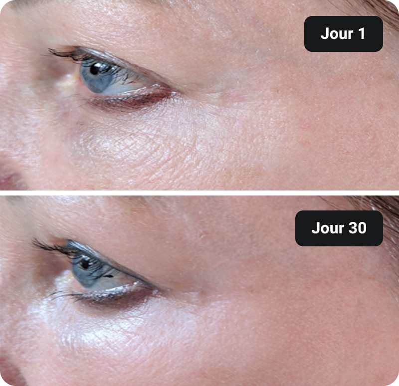 Bioactive Collagen Peptides before and after results