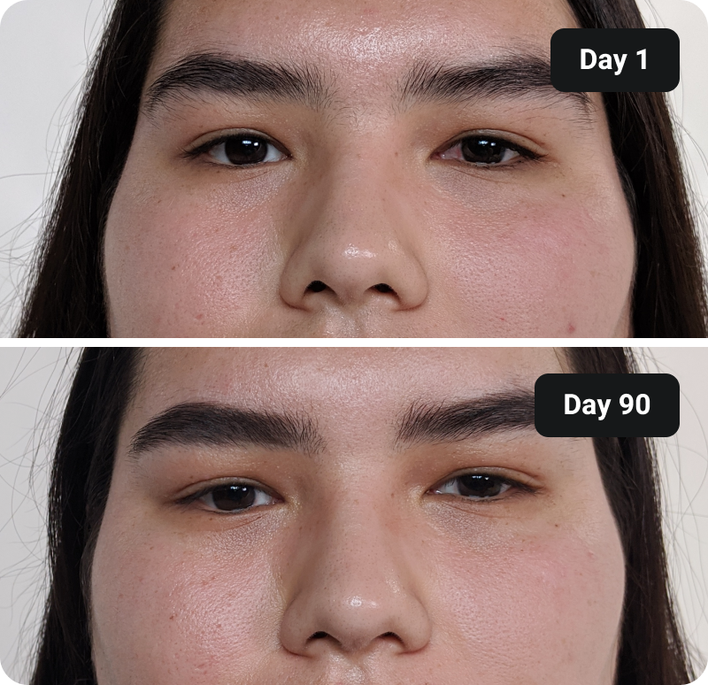 Bioactive Collagen Peptides before and after results