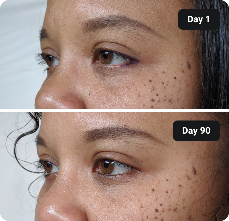 Bioactive Collagen Peptides before and after results