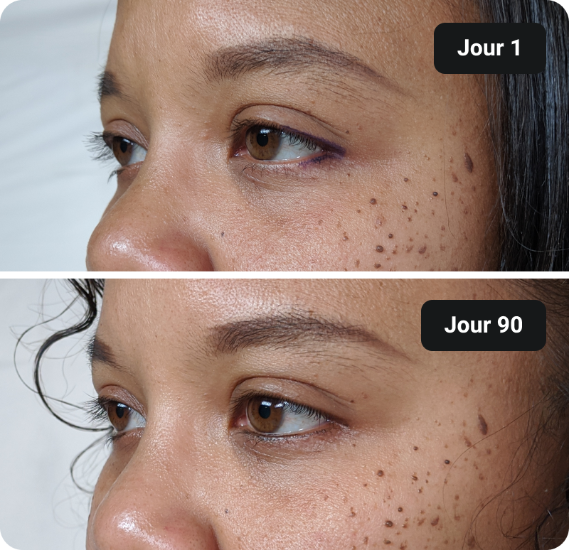 Bioactive Collagen Peptides before and after results