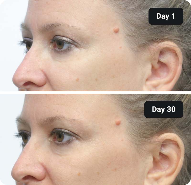 Bioactive Collagen Peptides before and after results