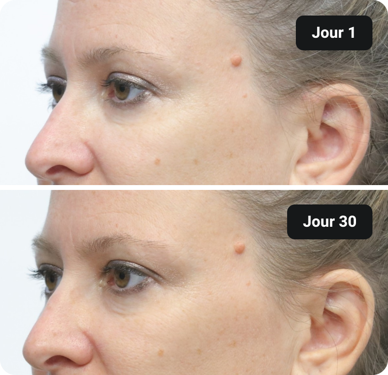 Bioactive Collagen Peptides before and after results