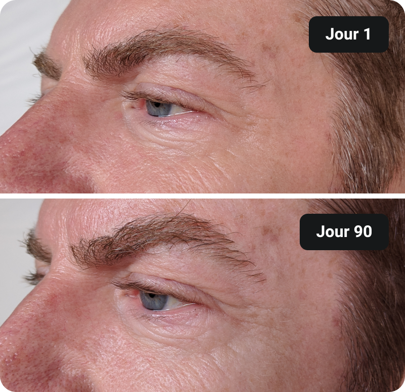 Bioactive Collagen Peptides before and after results