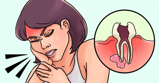 Ldixlxcpemr8tuqabgt6