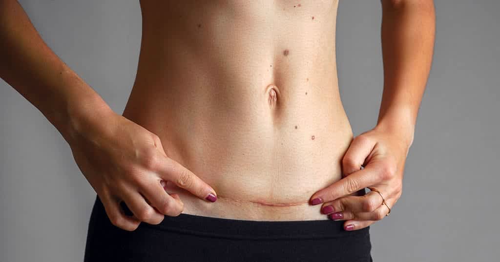 Lyjio26evys4zvzvi0wo