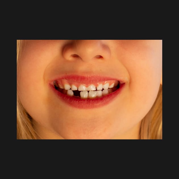 Smile! Super cute and really funny kid smile missing 1 tooth by mivpiv