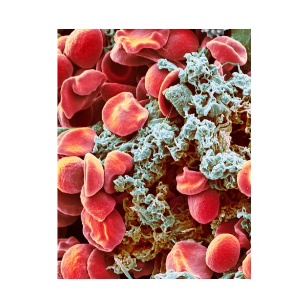 Red blood cells and platelets, SEM (F013/1526) by SciencePhoto