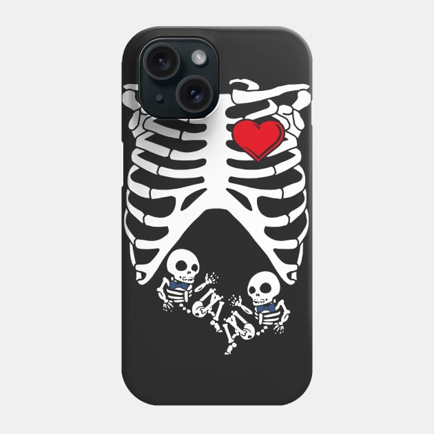 Spooky Skeleton Costume Pregnant Mommy of Twin Boys Phone Case by SolarFlare