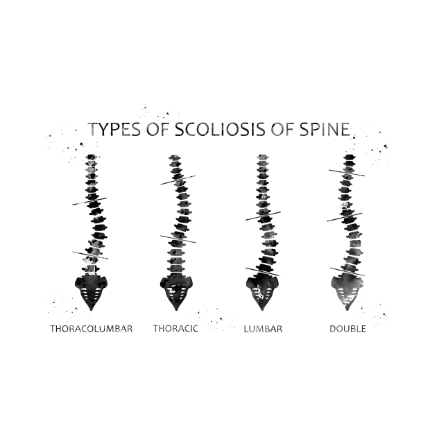 Type of scoliosis of spine by erzebeth