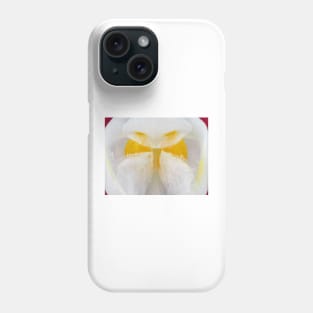 Orchid flower with pollen (pollinia) visible under the microscope Phone Case