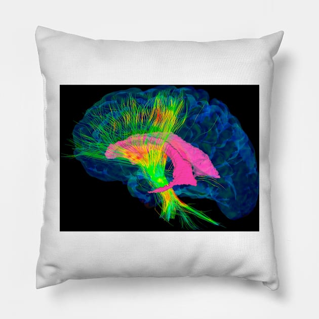 Brain fibres, DTI MRI scan (C017/7036) Pillow by SciencePhoto