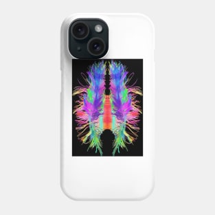 White matter fibres and brain, artwork (C015/1934) Phone Case