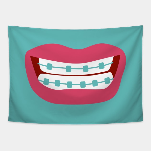 Woman smiling with teeth braces Tapestry by marufemia