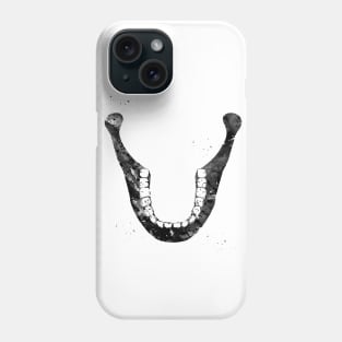 Human Jaw Skeleton Phone Case