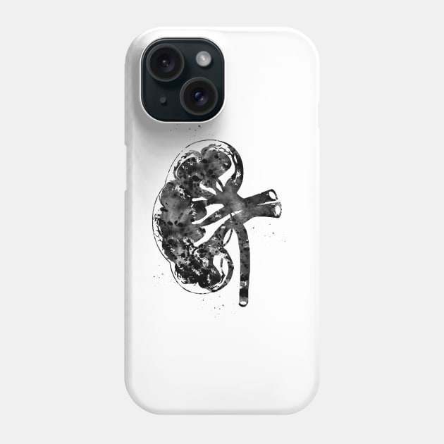 Kidney section Phone Case by erzebeth