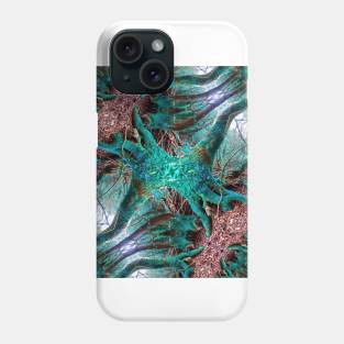 Forest Falling Phone Case