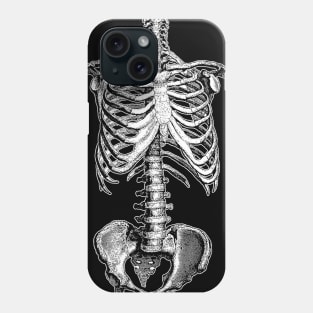 Skeleton - Vintage Illustration Design Phone Case