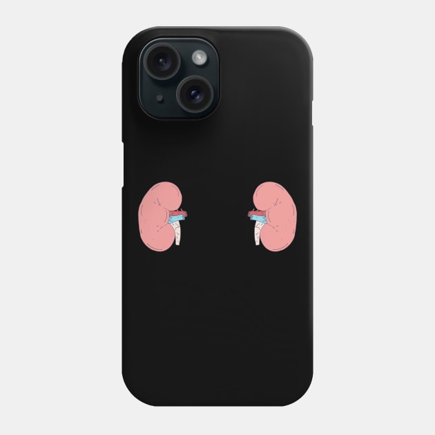 Kidney Transplant - Bean Shaped Graphic - Nephrology Phone Case by DeWinnes