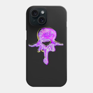 Lumbar Vertebrae 2 Phone Case