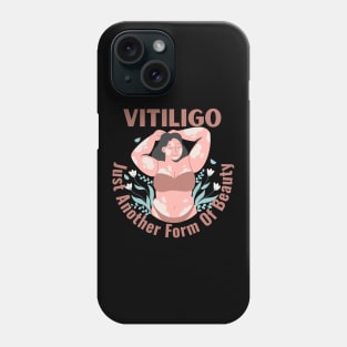 Vitiligo Just Another Form Of Beauty Female Model Phone Case