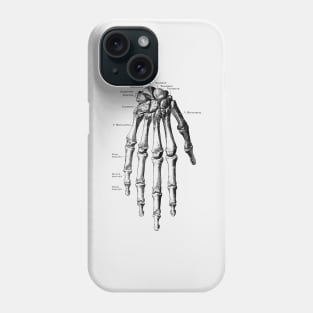 Down Facing Hand Skeletal Diagram Phone Case