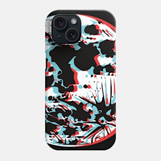 Full Moon Glitch Phone Case