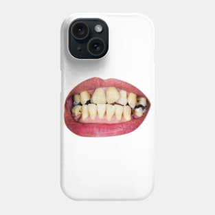 damaged teeth Phone Case