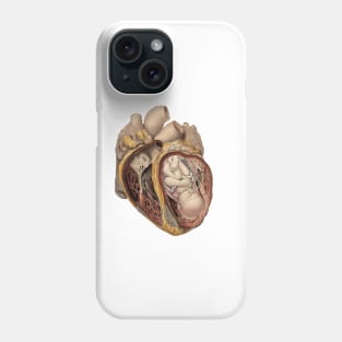 Born from the heart Phone Case