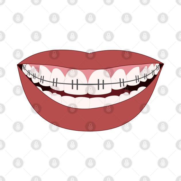 Big smile teeth braces mask design by AltrusianGrace