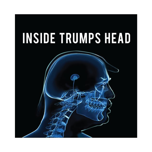 Inside Trumps Head by DavidLoblaw