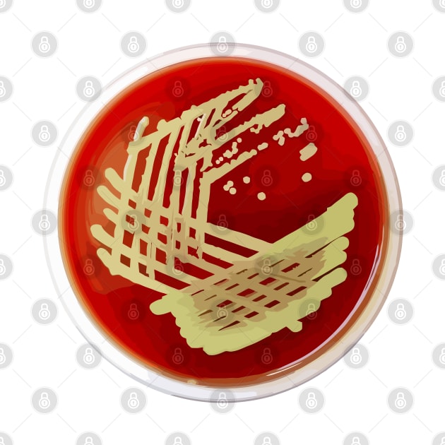 Bacterial Culture Streaks E.coli Petri Dish in Microbiology Lab Gold Red Yellow by labstud