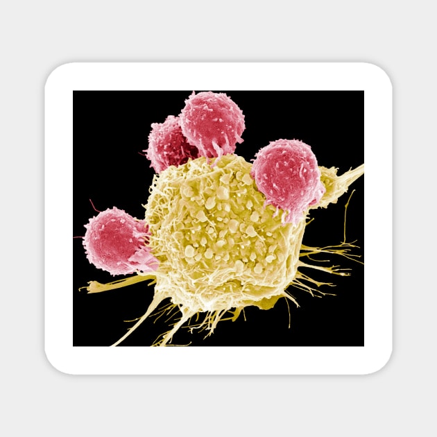 T lymphocytes and cancer cell, SEM (C001/1678) Magnet by SciencePhoto