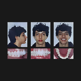 Esports and Tournaments