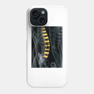 Human spinal intervertebral discs (F011/7098) Phone Case