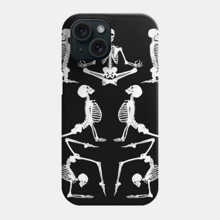 Stretch Them Bones Phone Case