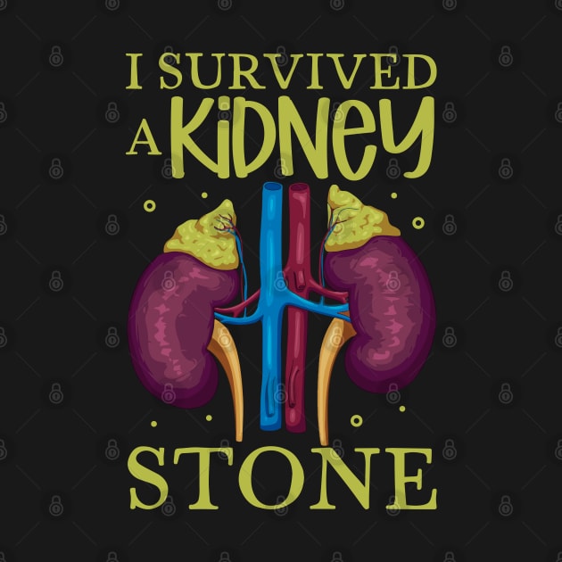 I have survived a kidney stone by Modern Medieval Design