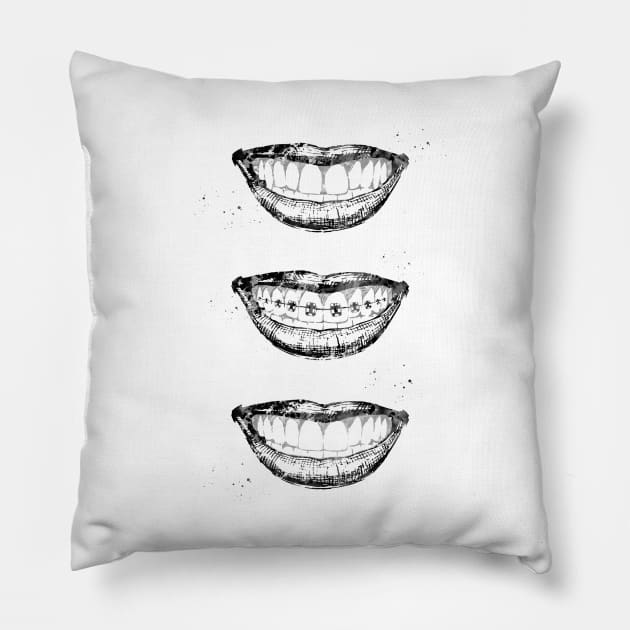 Before, with and after braces Pillow by erzebeth