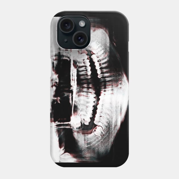 An X-Ray Phone Case by Opalescents